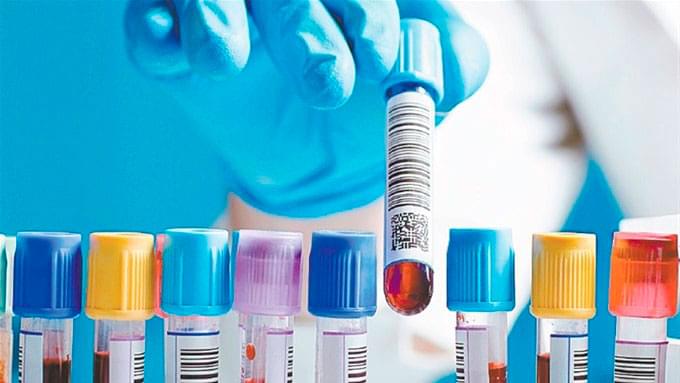 Diplomado en Salud en Laboratorio Clínico